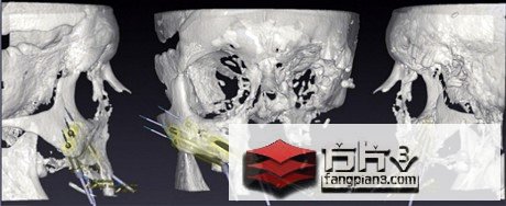 3D建模和骨骼重建