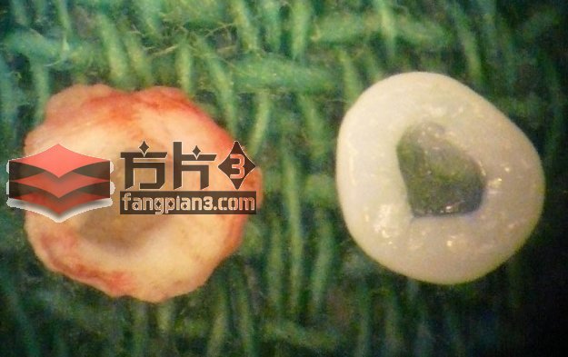 生物3D打印的椎间盘照片
