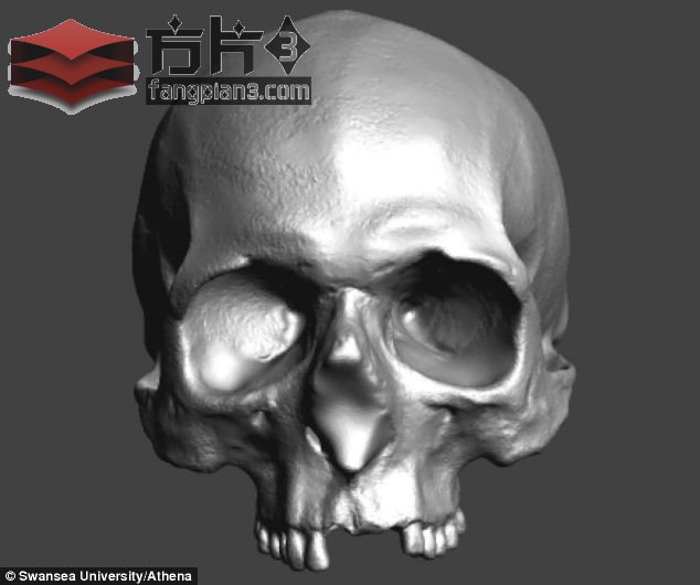 颅骨3D成像