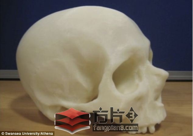 3D打印颅骨