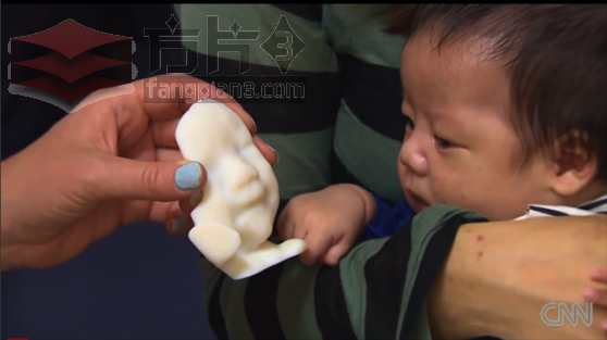 3D打印胎儿脸部