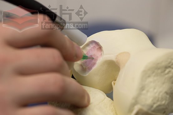 生物笔3D打印