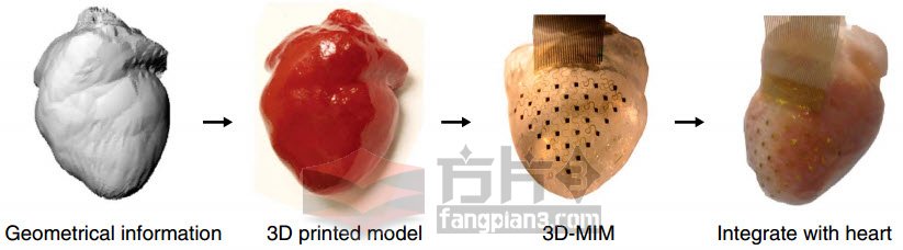 3D打印心脏裹膜