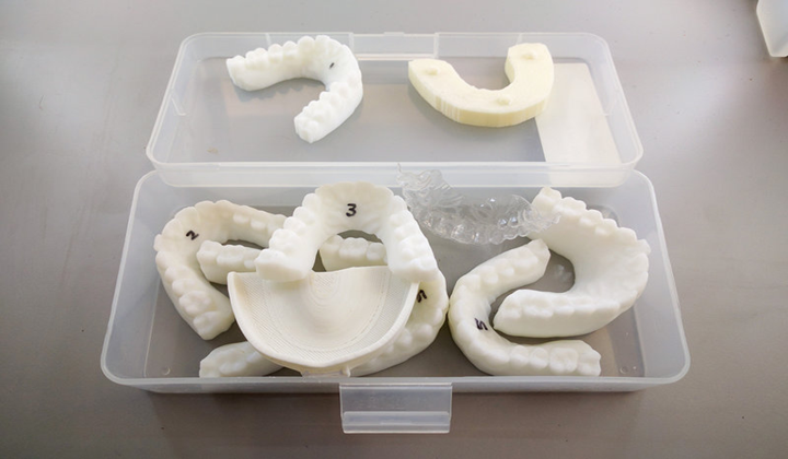 3D打印牙齿固定器—做自己的牙医